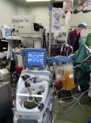 从禁忌到常规：自体血回收技术的临床突破与规